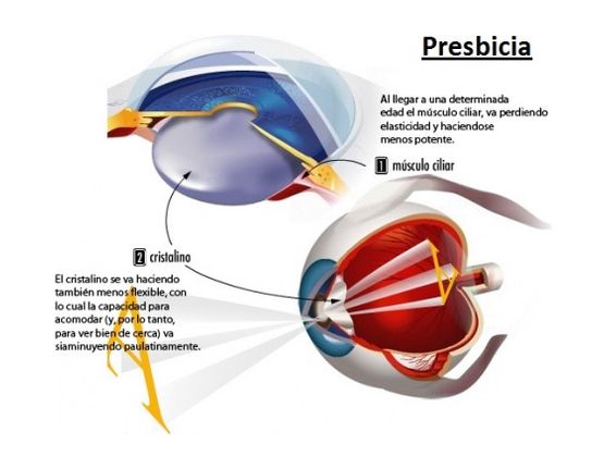 Javier Arbués Palacios oftalmología 4